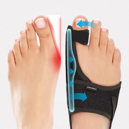 Night splint for hallux valgus